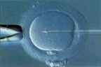 Fecondazione in vitro (Enrico Chiavacci)